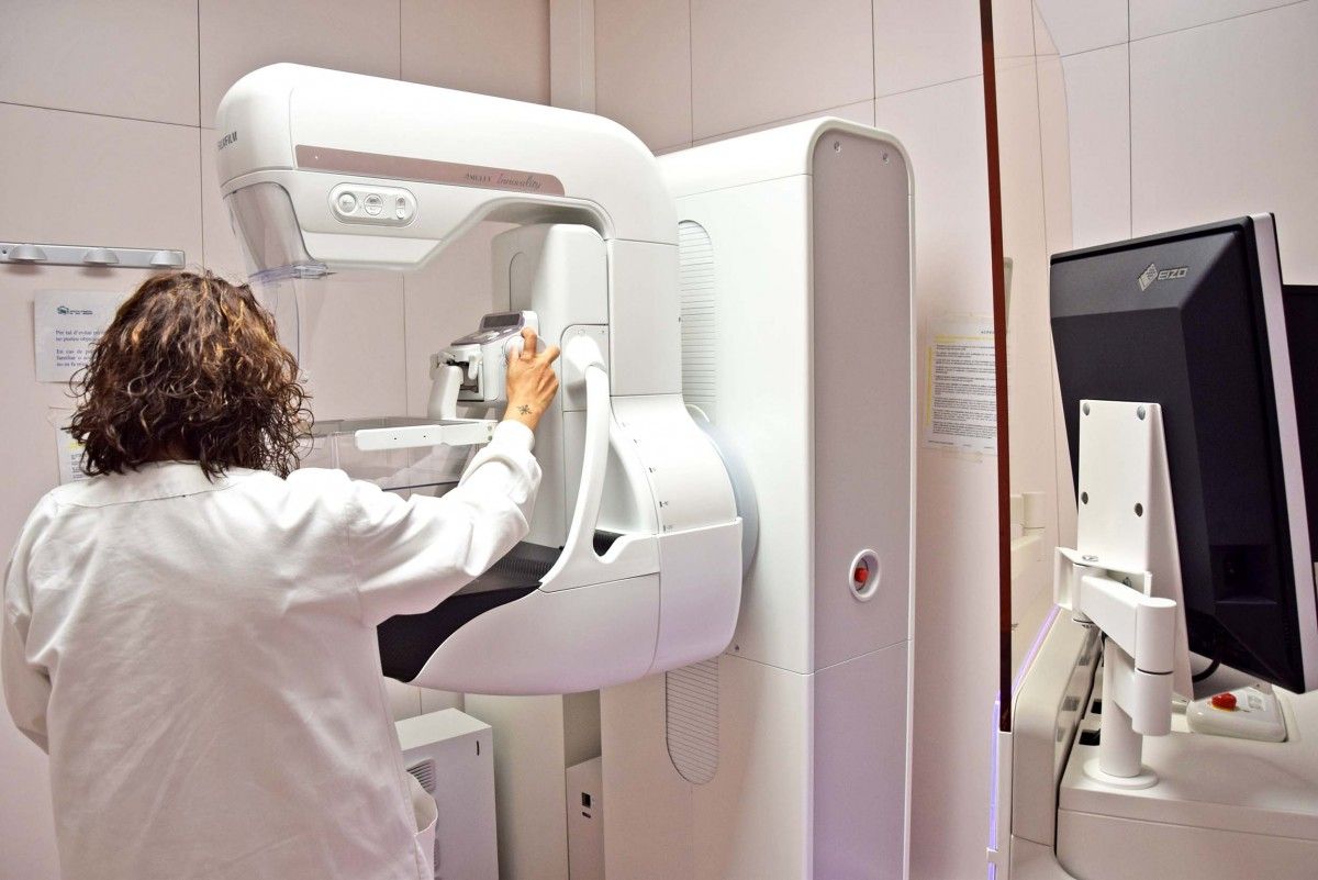 Un mamògraf en una imatge interior de l'Hospital Sant Bernabé de Berga (arxiu).