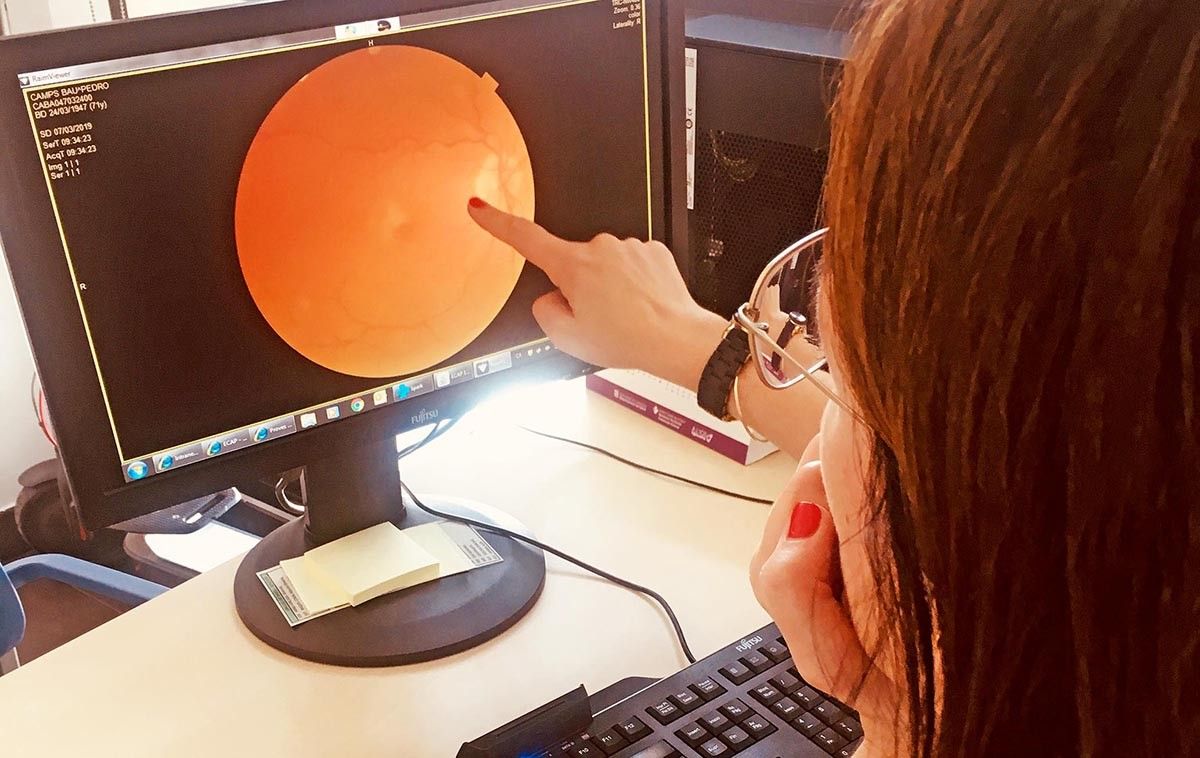 Una professional de la salut revisa un globus ocular