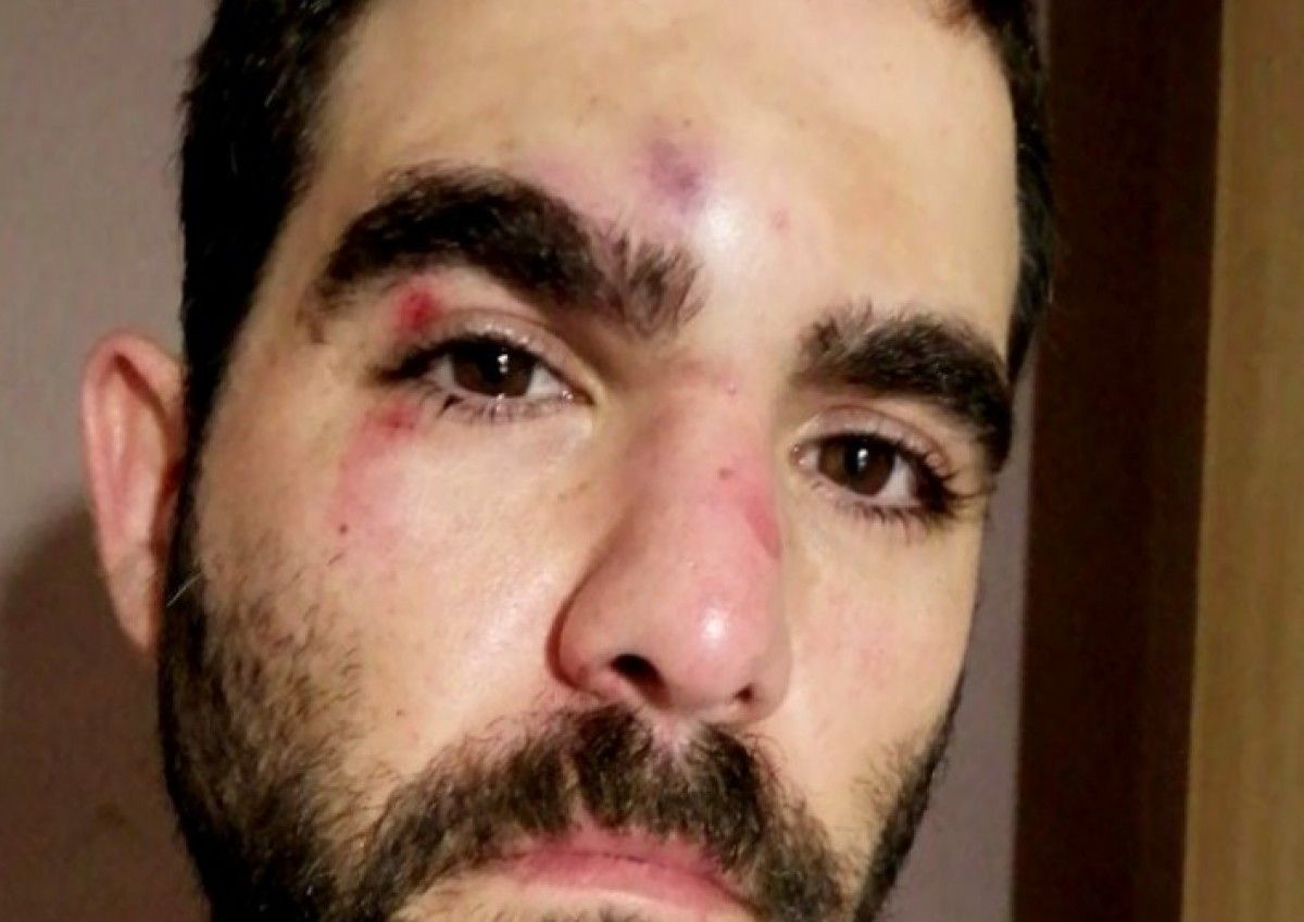 Les ferides del periodista Robert Calvo després de l'agressió.