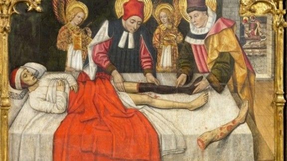El miracle de l'empelt d'una cama a un servidor de l'església