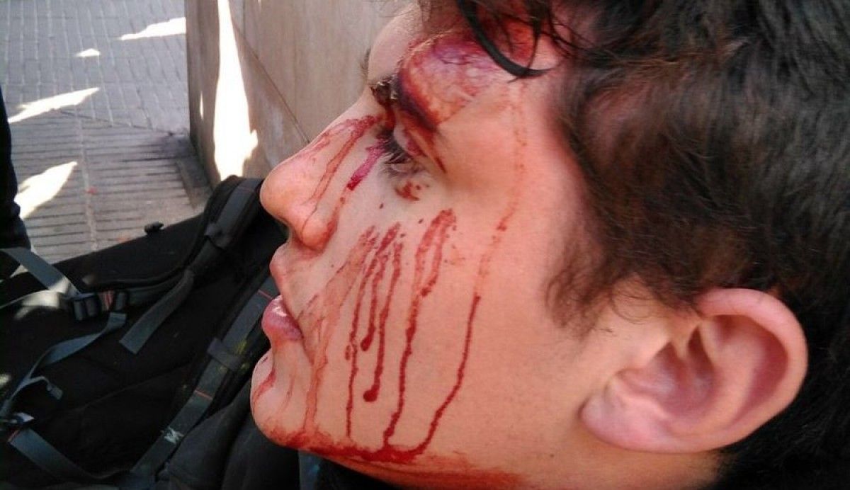 Imatge d'un jove ferit després de les càrregues policials