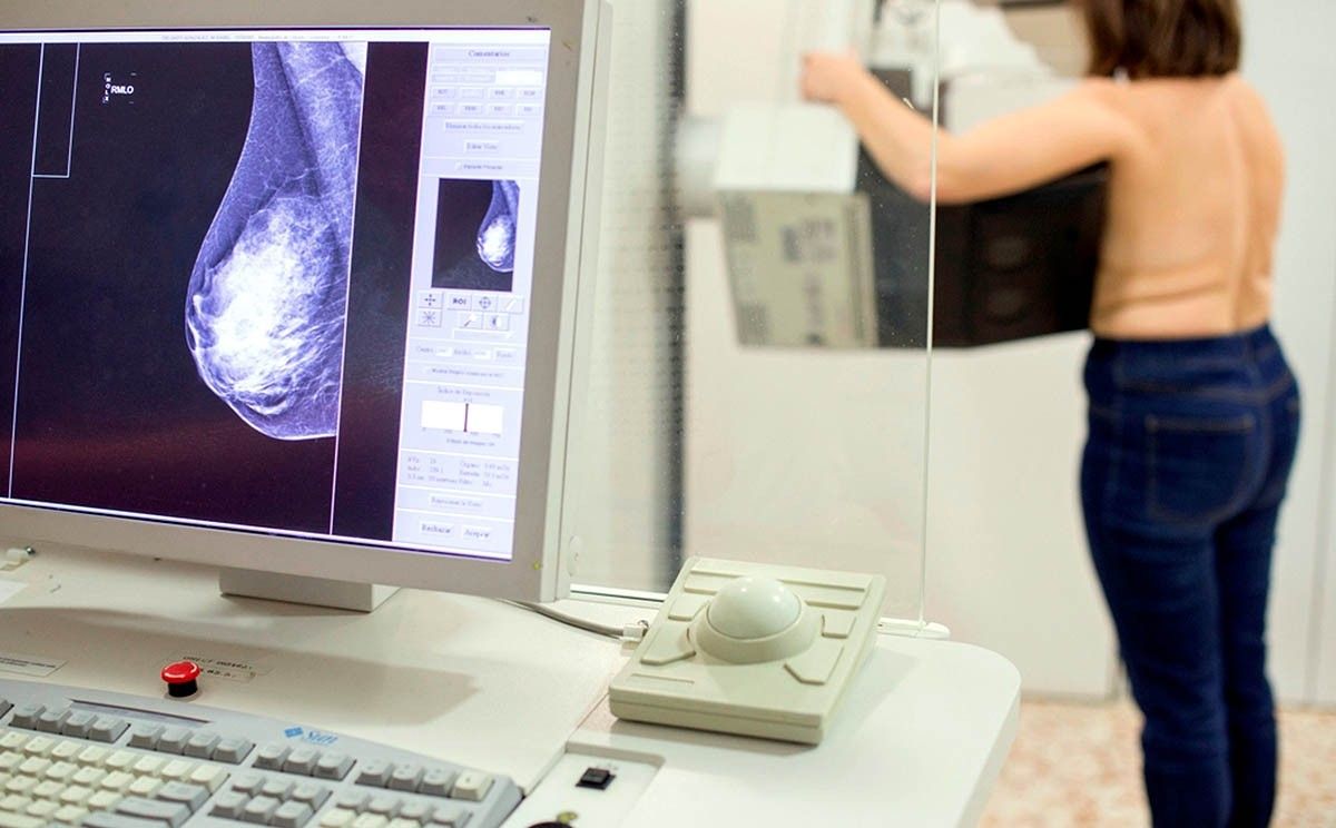 Una dona es fa una mamografia per detectar si té càncer de mama. 