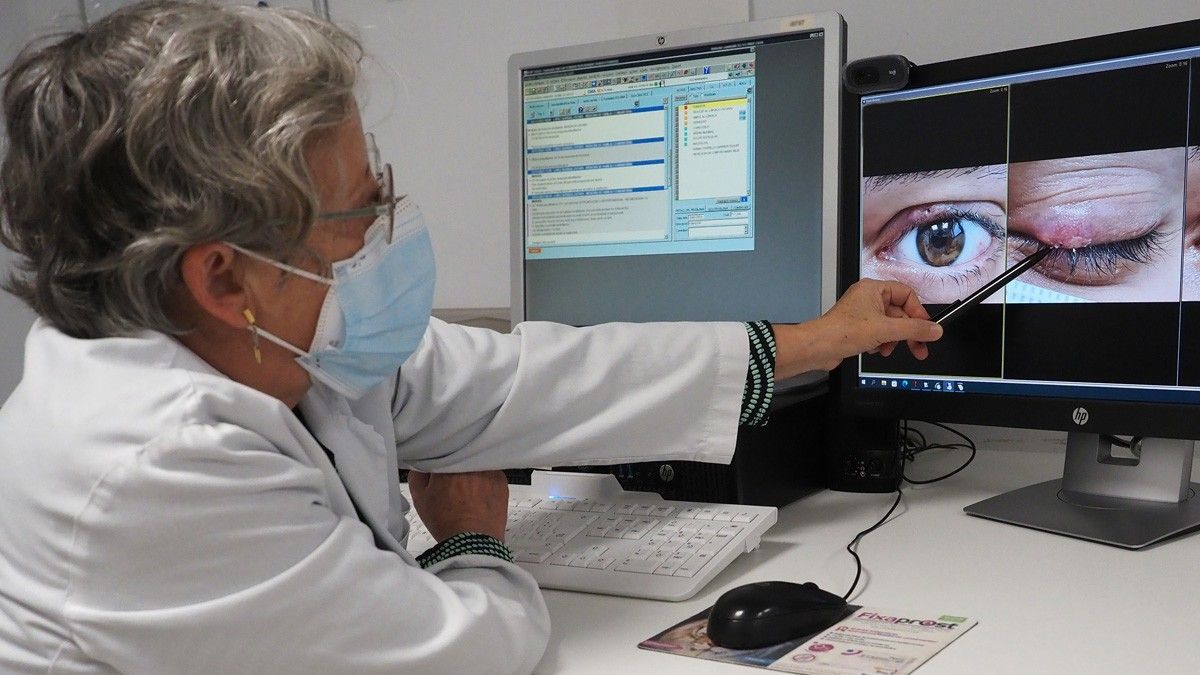 El servei d'oftalmologia valora una possible patologia a les parpelles