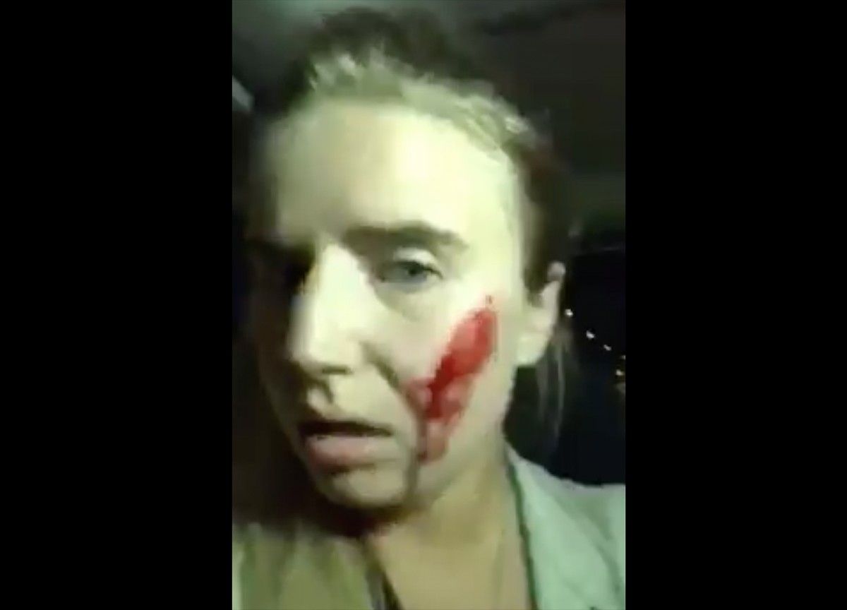 La jove denunciant la ferida després d'una persecució en cotxe