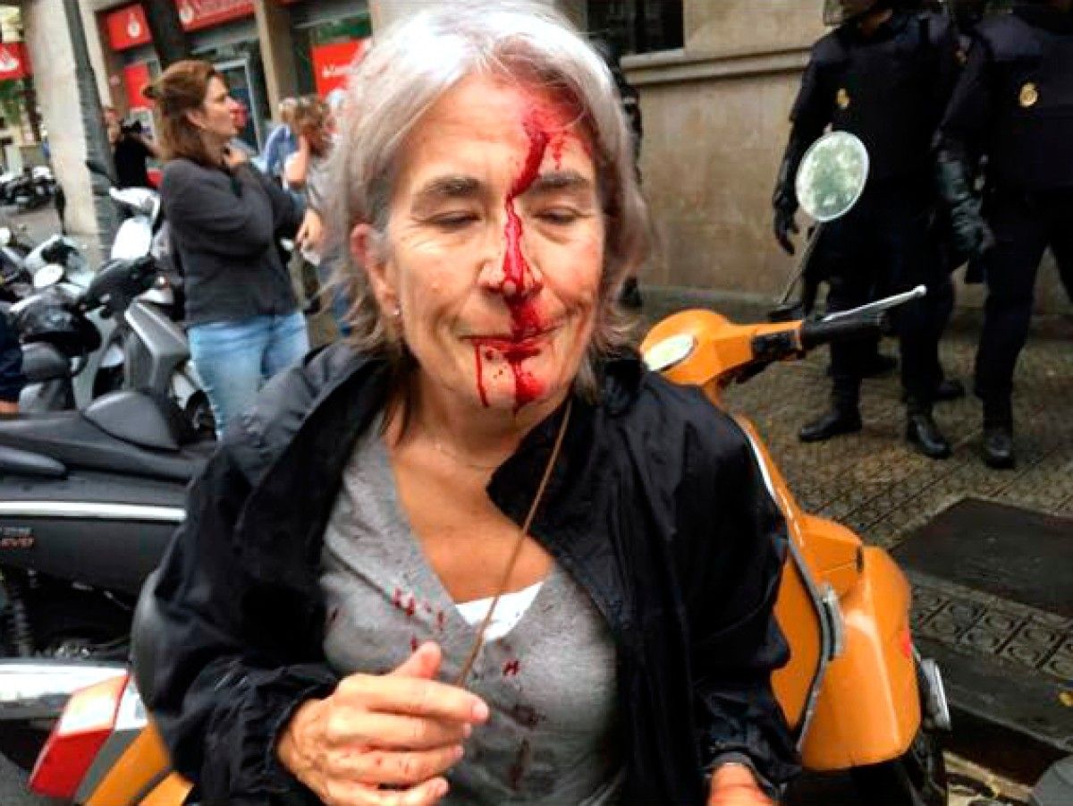 Primer pla de la cara ensangonada d'una dona davant l'Escola Infant Jesús de Barcelona, després d'una càrrega policial l'1 d'octubre del 2017.