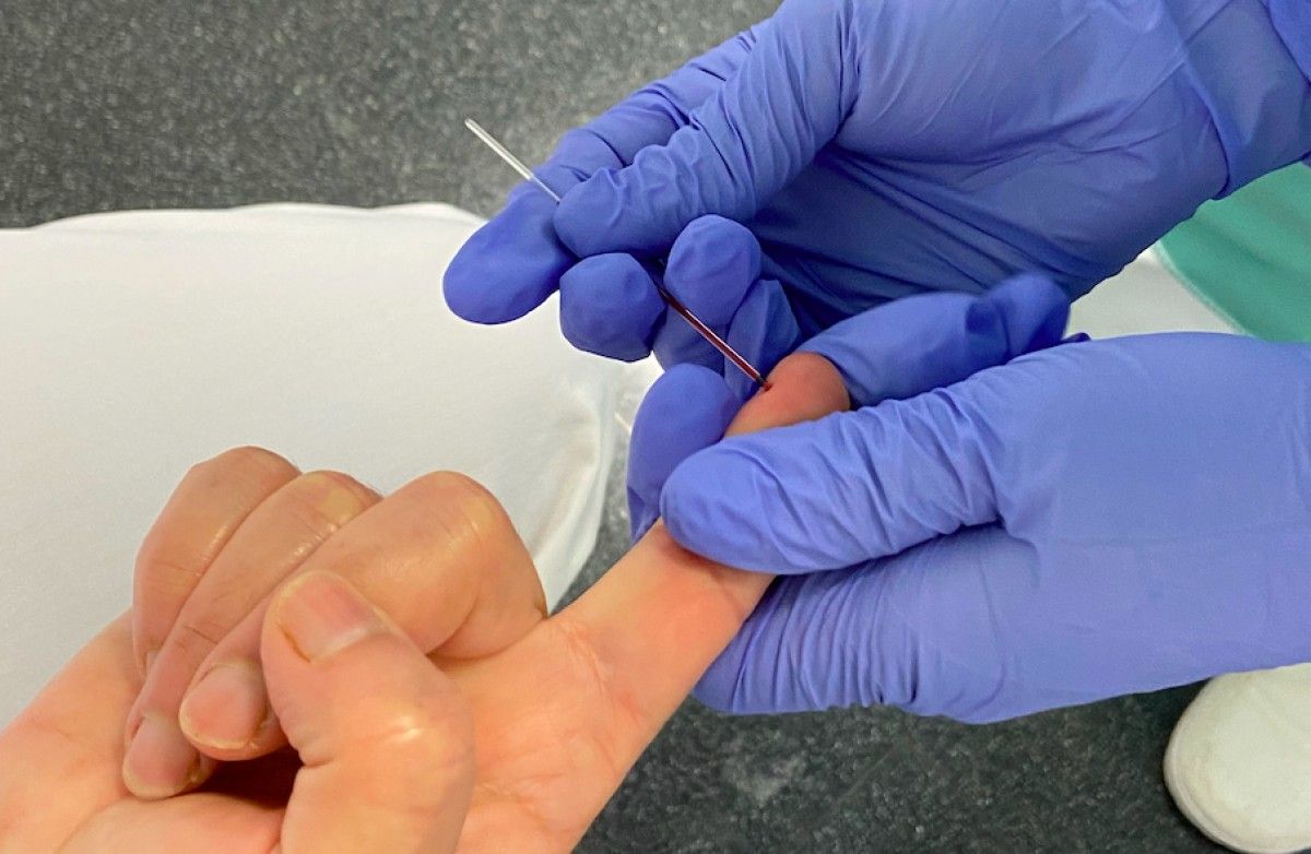 L’extracció de la mostra es fa a través d’una gota de sang, que s’agafa d’una punxada al dit.