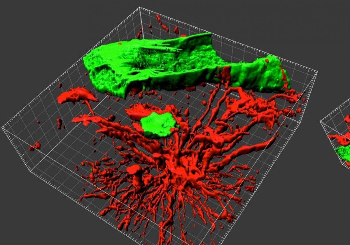 Imatge d'un tumor analitzat amb tecnologia en 3D